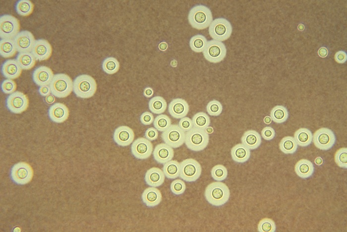 Cryptococcus_neoformans_using_a_light_India_ink_staining_preparation_PHIL_3771_lores